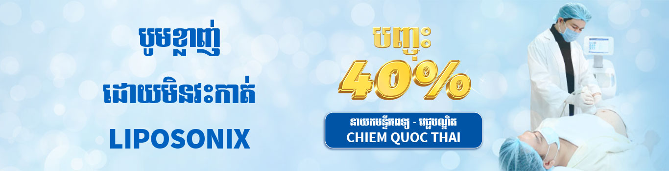 Banner hút mỡ không phẫu thuật giảm 35% - KM